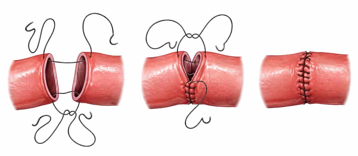 Dr Luis Felipe Cabrera Vargas MD FACS tweet media
