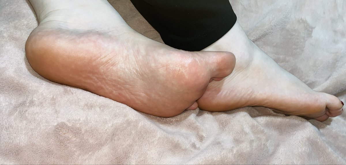 Cherrysteps tweet media