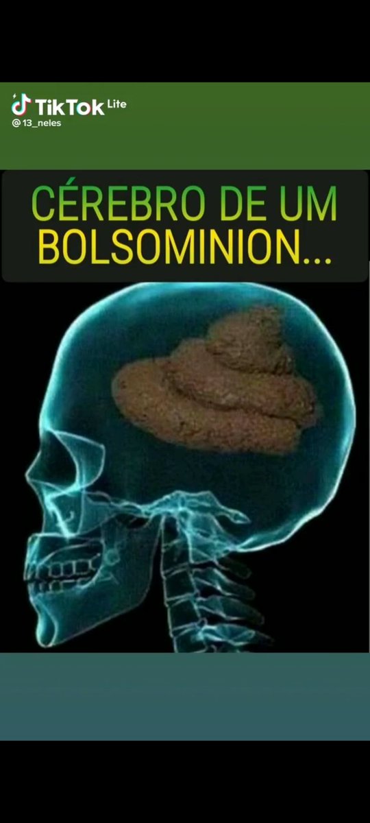 elainets_'s tweet photo. @roberta_bastoss Esse é o cérebro de um bolsominion! https://t.co/2z3qfp5i8w