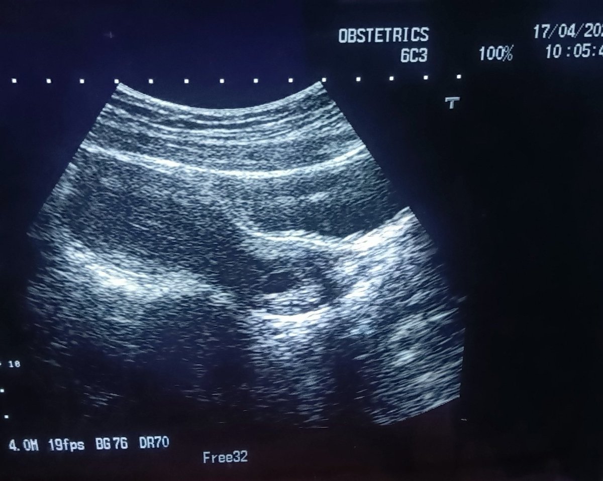 ChroRadGirlie tweet media