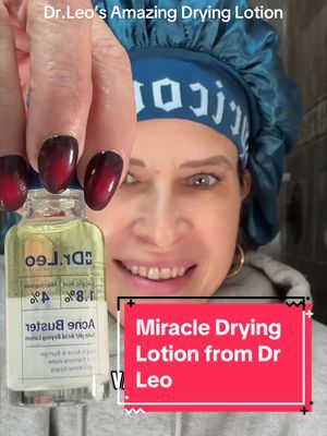 karmadefuego's tweet image. Check out my latest video on TikTok: This product WILL eliminate your pimples! I don’t know what magic is in this (actually it’s salicylic acid, niacinamide, and sulfur!) but it works! Love you mean it.🫶🏼 @DR LEO OFFICIAL STORE PH  #acne #breakouts #sk… ift.tt/X9oEDTy