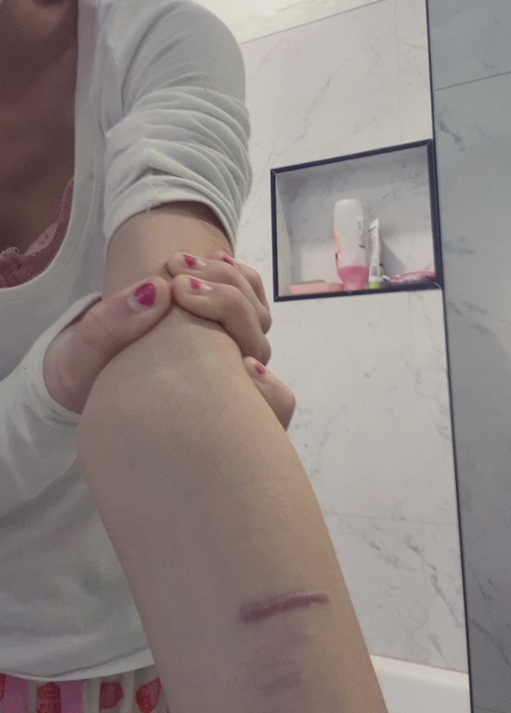 cupcakebunniie's tweet image. i miss my lw ☹️
#bodycheck #edtwt #bc