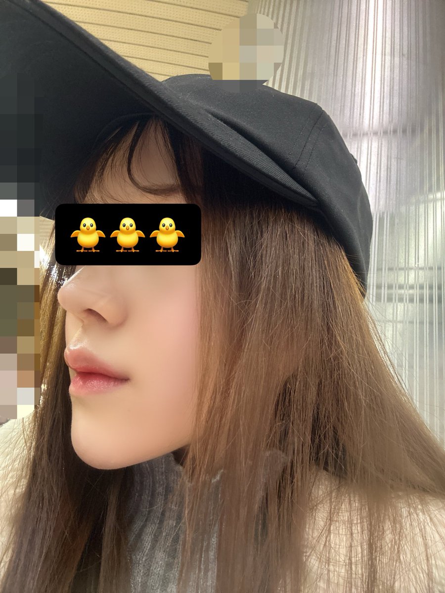 🩶 輪郭3点＋鼻フル(再)、額挙上、自然癒着目つき矯正dt tweet media