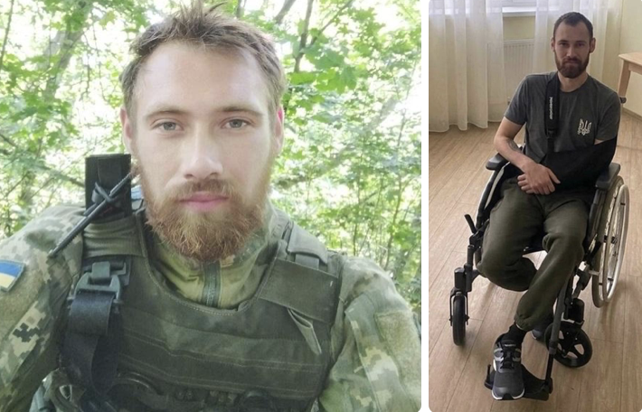 ❗️Просимо всіх підтримати 🤝 потрібна тривала реабілітація.

🫡🇺🇦Андрій Сизон, позивний ФАРАОН
банка Андрія: send.monobank.ua/jar/3AYe9j7SSm

- "Осколок влучив у голову.

Я прийшов до тями на кілька хвилин. Навколо все гуділо від вибухів – міномети, артилерія. Побратими врятували мене.