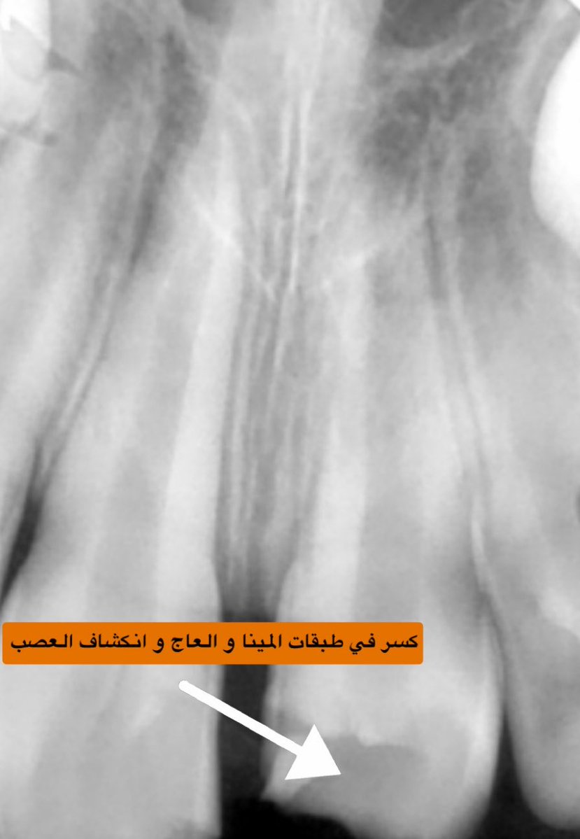 Salma AlKhuwaitir tweet media