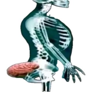 HectroDosis tweet media