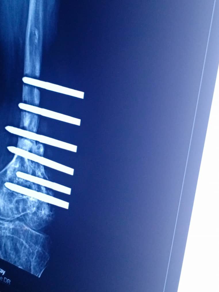 Bamimosu Mariam tweet media