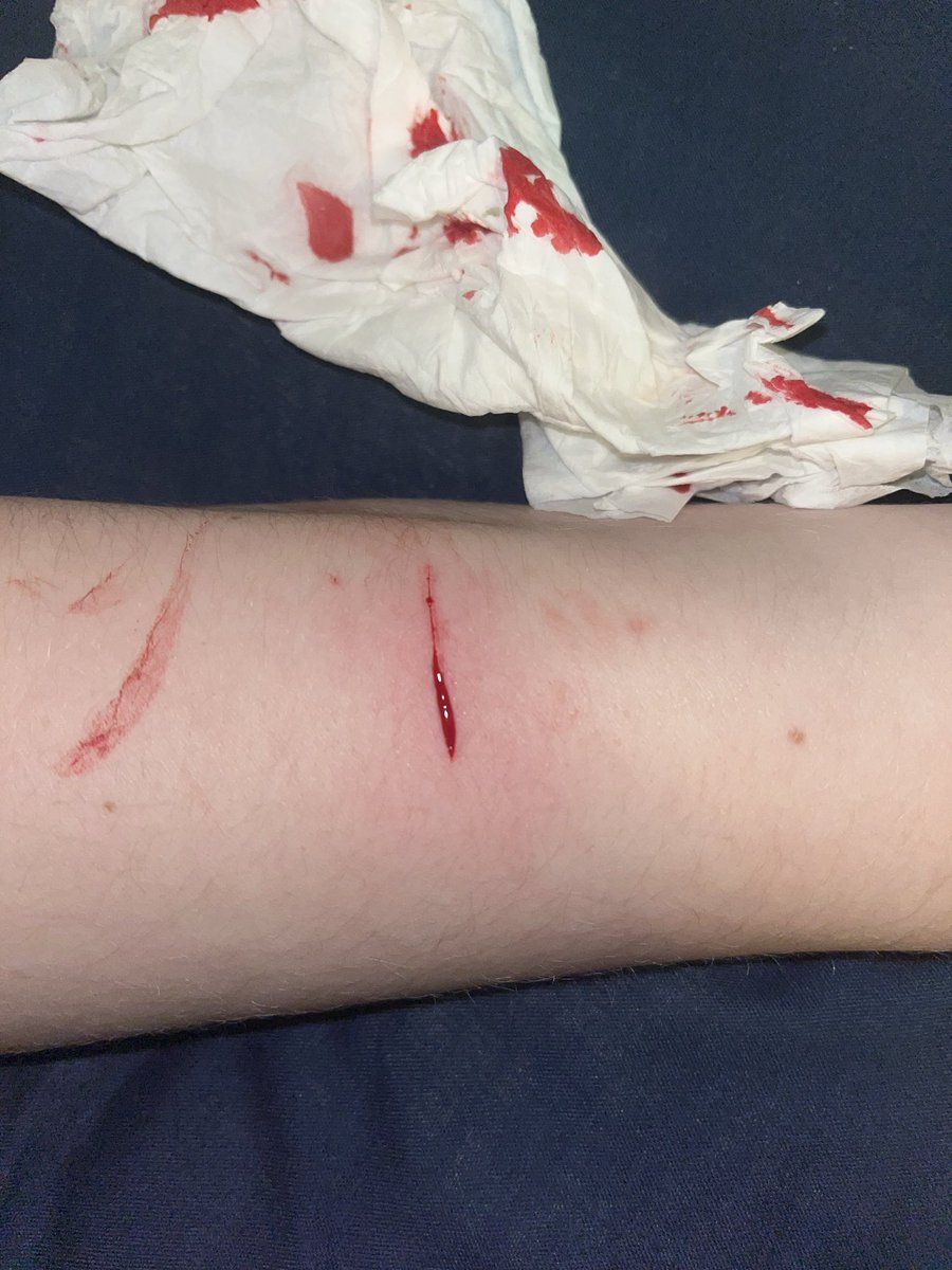 pepi of shedtwt tweet media