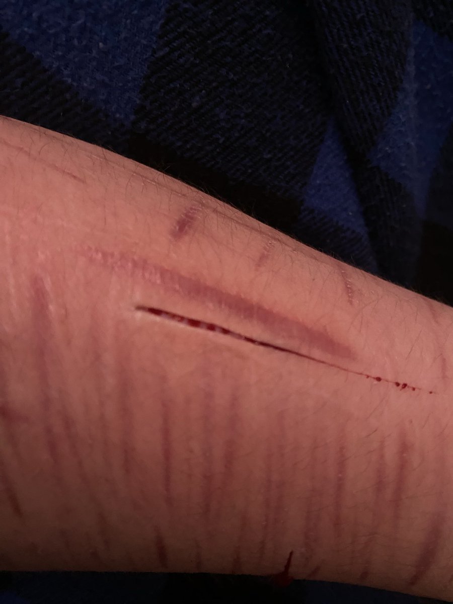 landmarkcourage's tweet photo. Don’t stress yourself out
#shtwt 

Open wound, vent art https://t.co/P4IRl7omBa