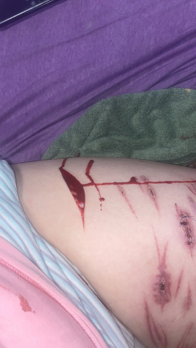 BWMD1019's tweet photo. One swipe #shtwt SFX makeup https://t.co/24BukDQmeE