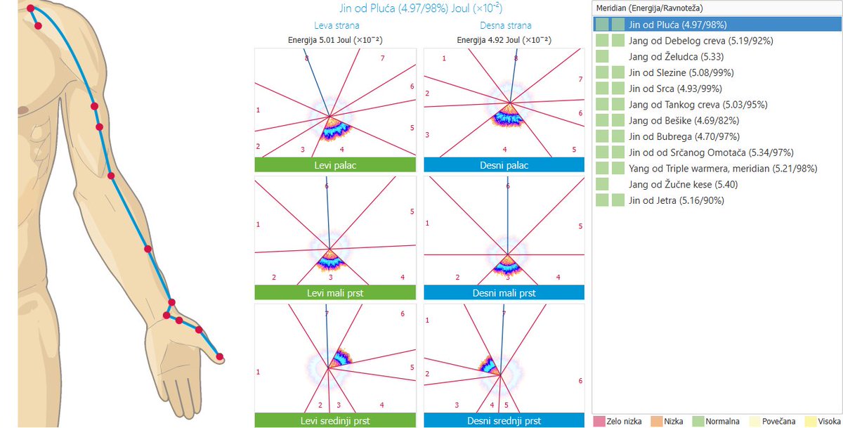 SmartsWayBosnia's tweet image. عندما تكون الميريديان متوازنة، تتدفق الطاقة بحرية ويعمل الجسم بانسجام.🧘‍♀️💆‍♂️
وعند حدوث خلل، قد يظهر التعب، التوتر أو ضعف في وظائف الأعضاء.

فهم طاقة جسمك هو أول خطوة نحو التوازن والصحة.
#energy
#vitality