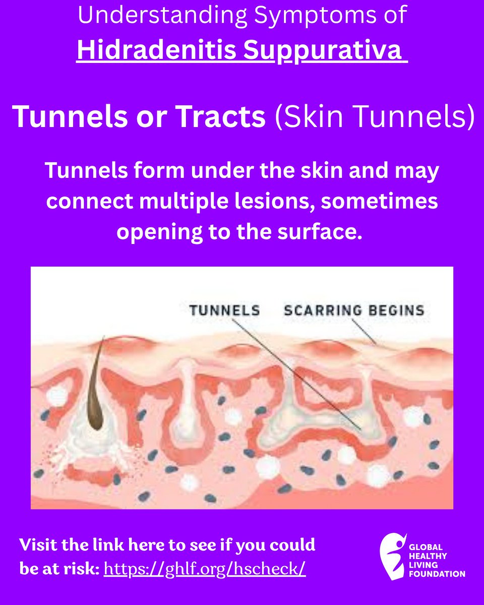 CreakyJoints.org tweet media