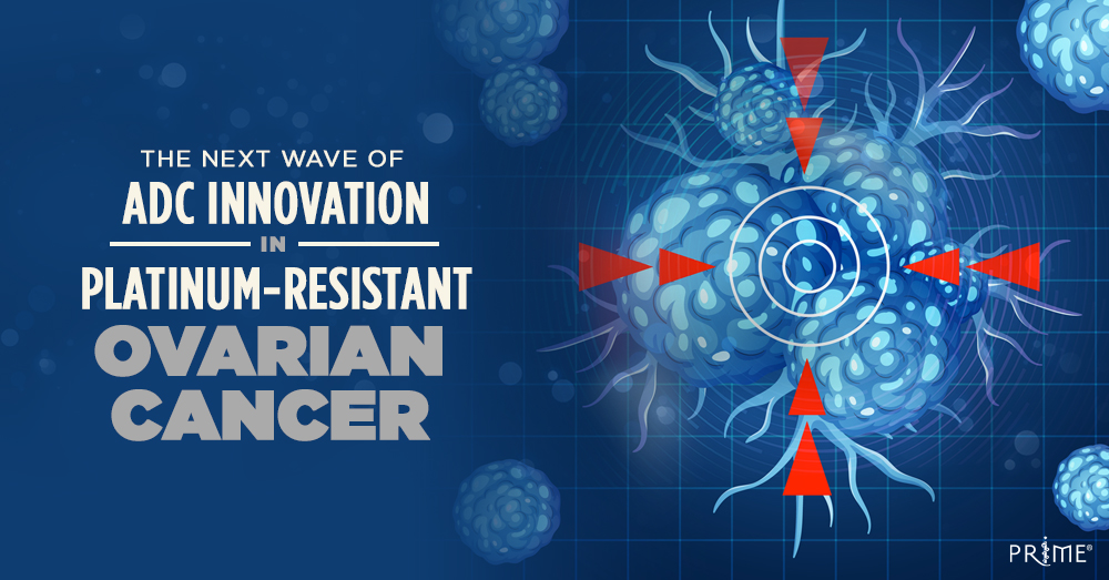 PRIME_cme's tweet image. PROC's expanding treatment landscape | The Next Wave of ADC Innovation in Platinum-Resistant Ovarian Cancer | 0.5-hour CME/CE | On-Demand Video | #MedEd #cme #OvarianCancer | bit.ly/4uXAH4s