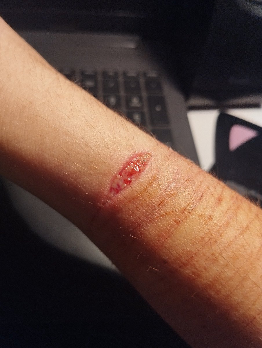 sh4lex's tweet image. SFX MAKEUP!! FAKE
the most prettiest beans I got, I still love how It looked... 
#subtwt #shtなりきりさんがrtしてくれてそれを見たshtなりきりさんがきっとフォローしてくれる #beans #sh #shtwt