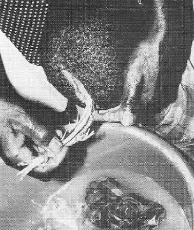 Joe__Bassey's tweet photo. Our ancestors used herbs to cure diseases and illnesses while performing different surgeries such as brain surgery, cranial surgery, bone setting, tooth extraction, cataract extraction, cervical lymphadenectomy, limb fracture immobilization, abdominal wound treatment, etc., for centuries, even till date.

African surgeons used compression of the carotid arteries to induce loss of consciousness and of peripheral nerves to achieve regional analgesia.