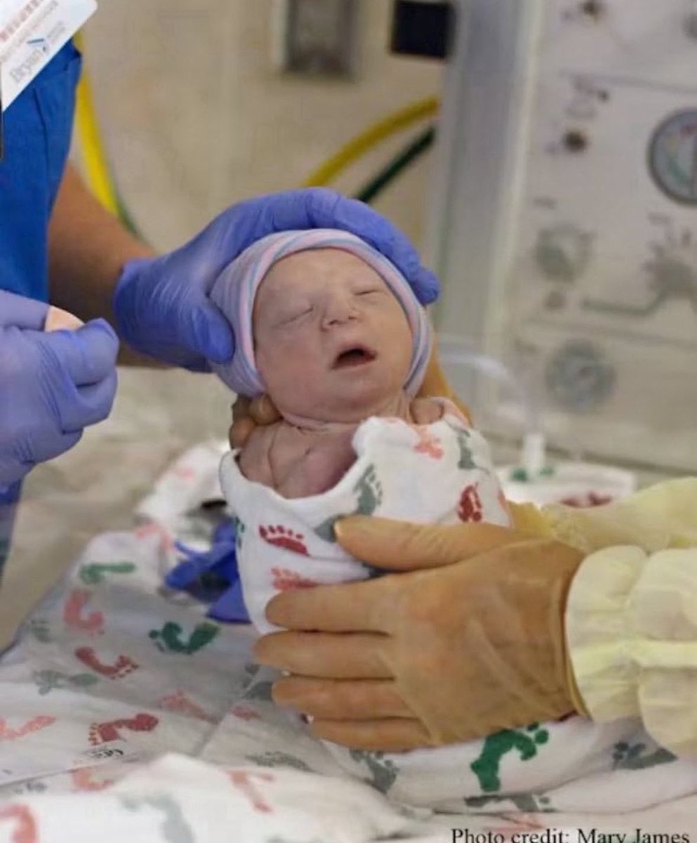 Anna Lulis tweet media