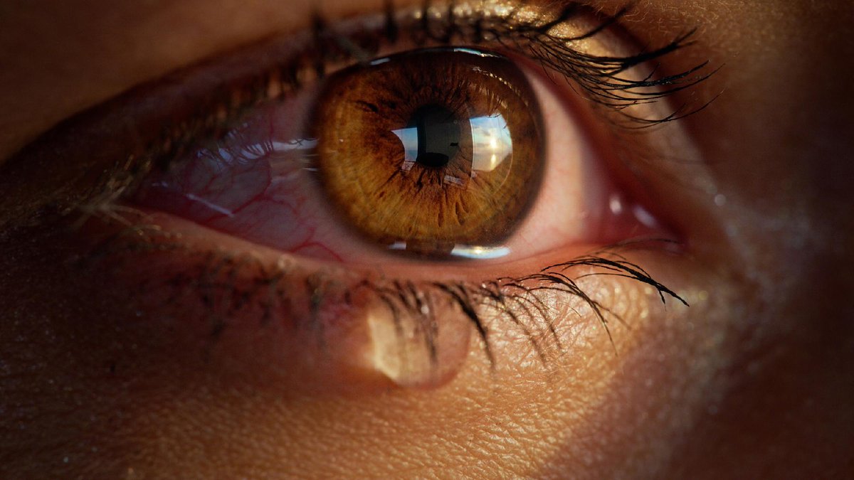 KECKSchool_USC's tweet photo. USC just got $7.8M from @ARPA_H to build a rice-grain implant that reads your tears and auto-delivers medication. Dry eye disease first. Cancer, Alzheimer's, depression next. https://t.co/HrcTohgrXr @USCEye @USC #DryEye https://t.co/Amy90kprlz