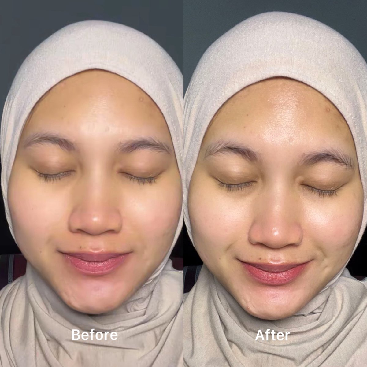 rarevii21's tweet image. Kalau kulit lagi kusam, wajib banget deh pake serum ini 🫶

OMG Brightening Expert Serum ✨

#serum #brighteningserum