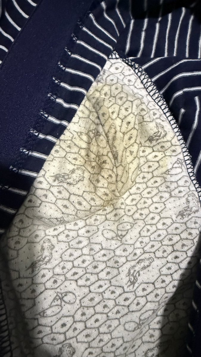 原味小黑皮 tweet media