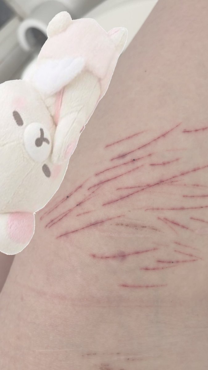 ʚɞ 🧁 𓈈 tweet media