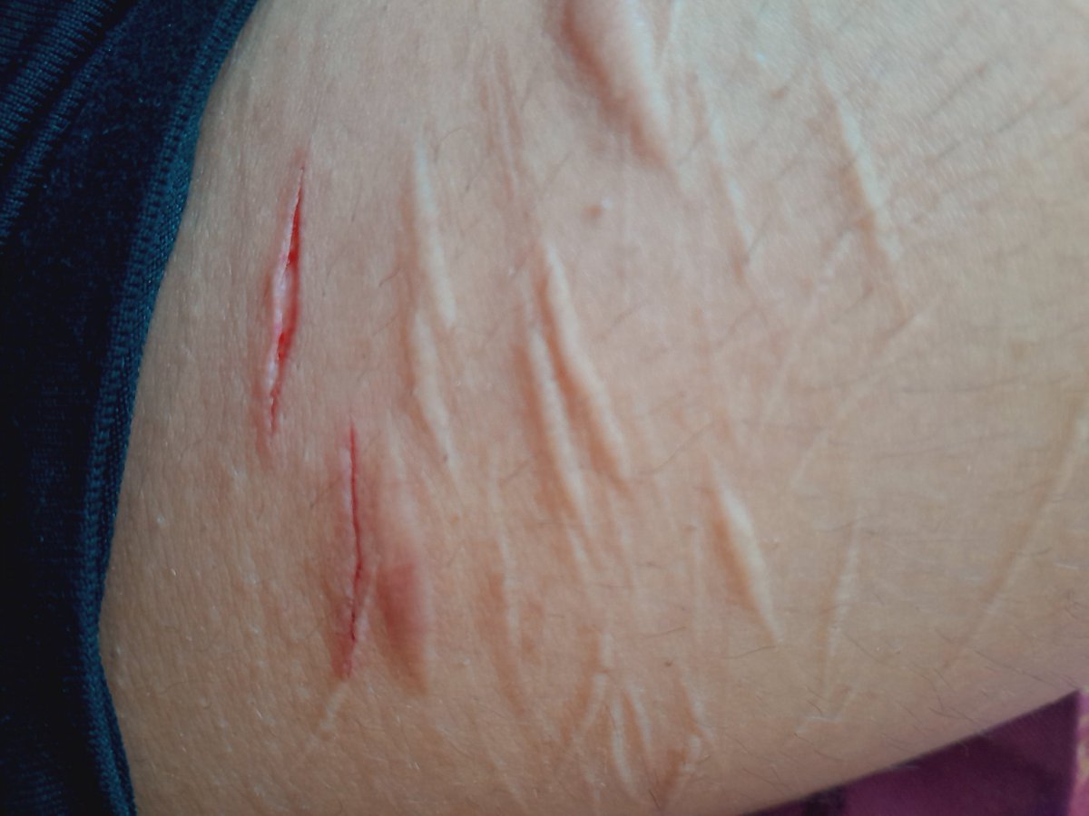 7Lob0tomy79254's tweet image. #shtwt
Voi a m0r1r en flop pwro bue xd ^_^
 zolo kiero subir mis cortes pq zi :v
#XD