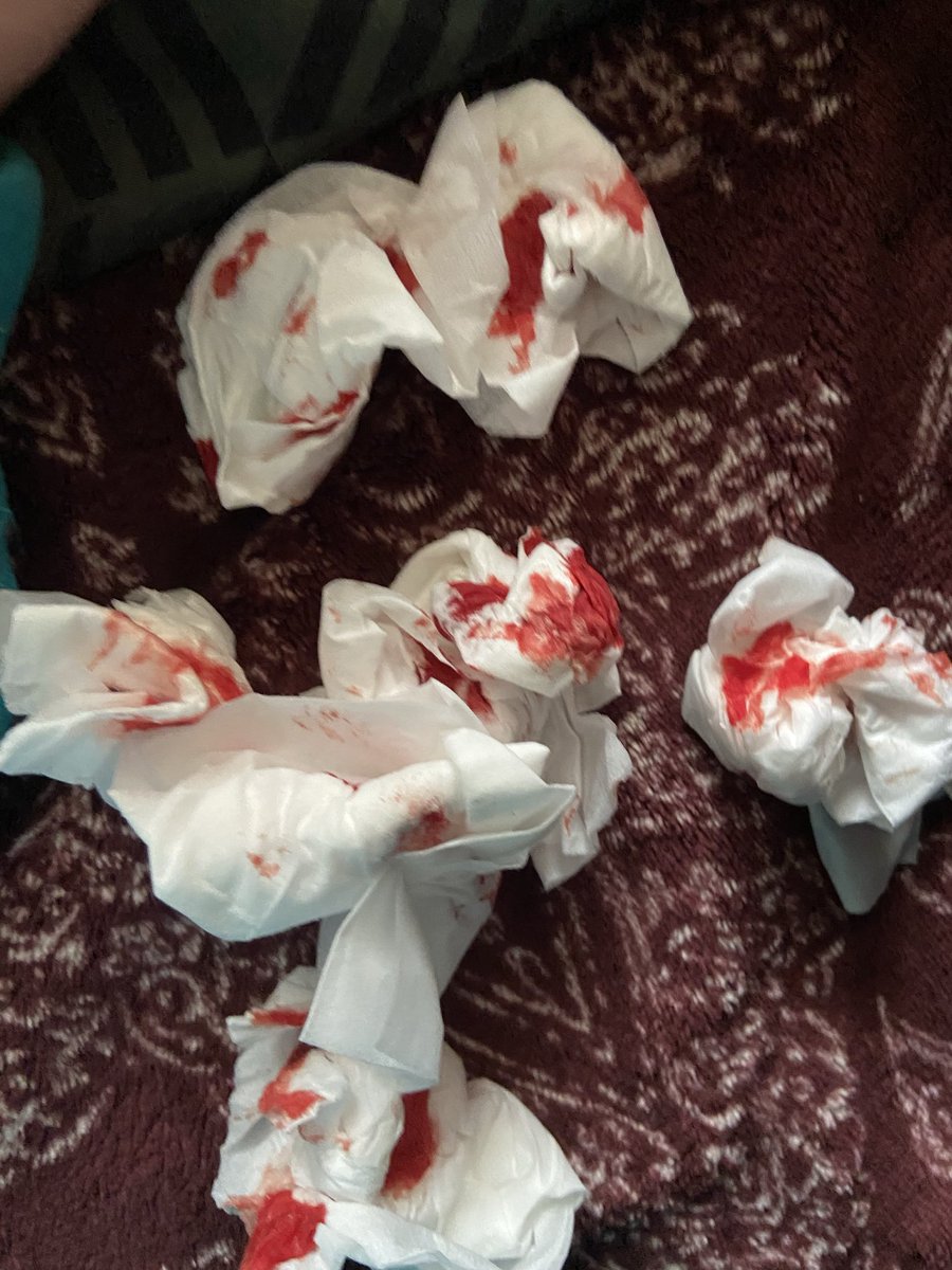 あくあ tweet media