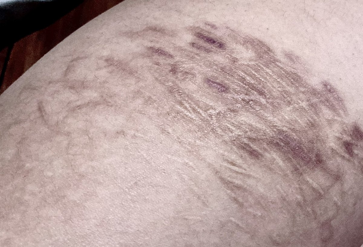 ( ˶°ㅁ°) !! tweet media