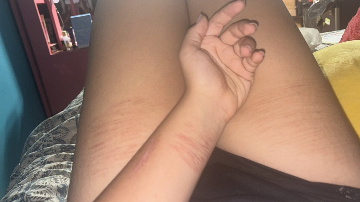 x.D34d._.4Ng3L.x tweet media