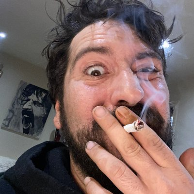 rony7729's tweet photo. @FretOnswitch @DrewCouver56 "shit skins face" https://t.co/XsAhbvcVbT