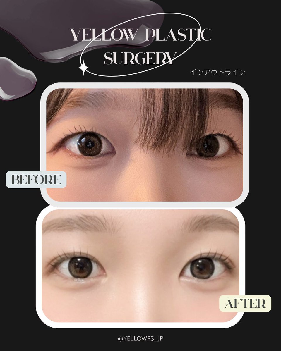 💛イエロー美容整形外科(公式)💛 tweet media