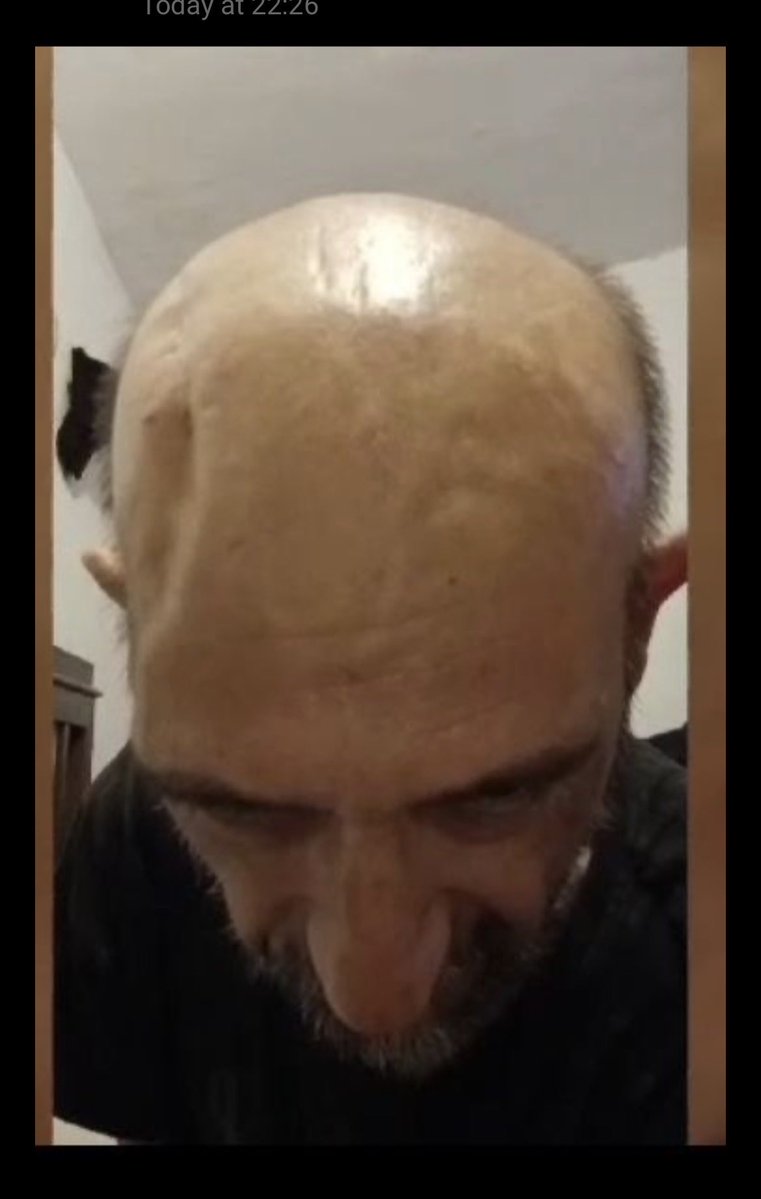 Elmewetero tweet media