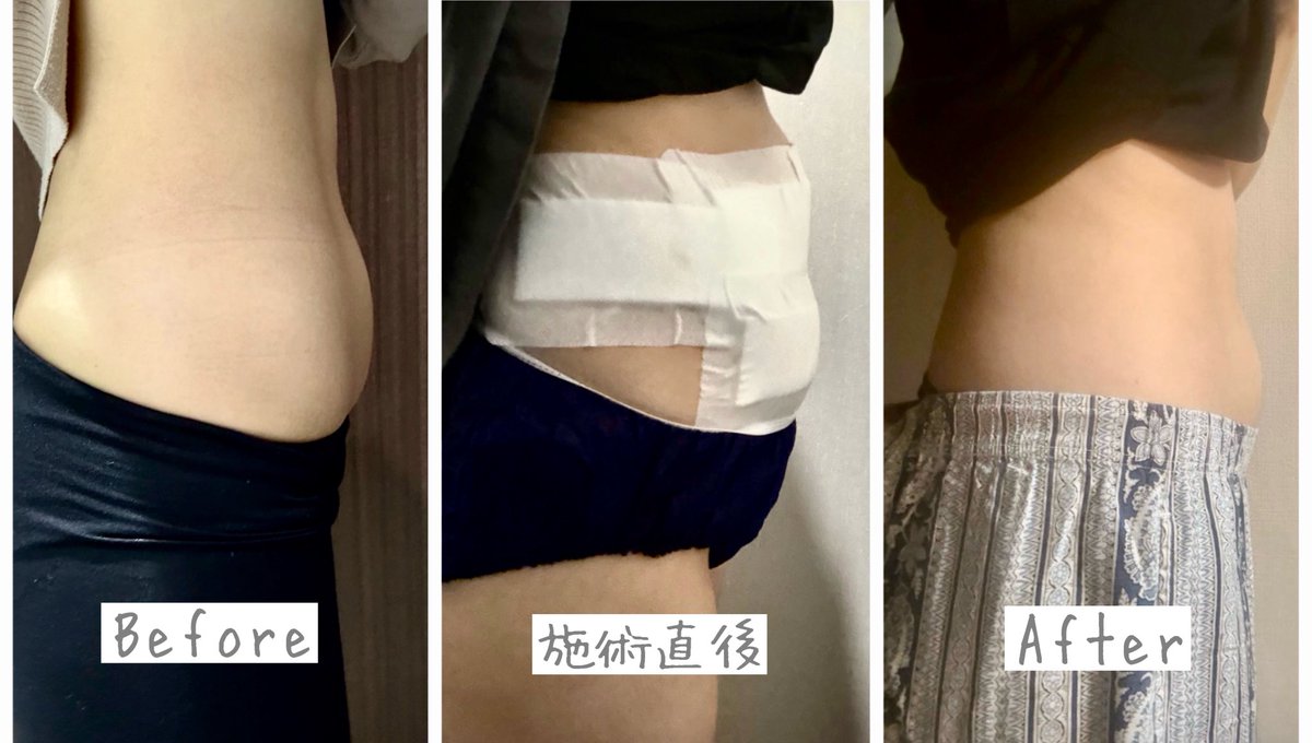 ぱび🍍肌管理ｺｽﾊﾟｵﾀｸ tweet media