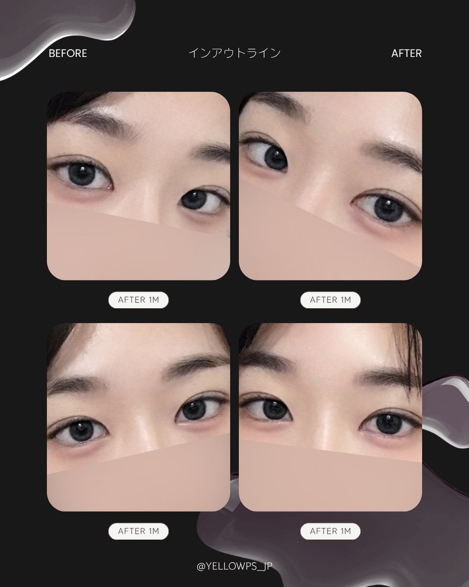 💛イエロー美容整形外科(公式)💛 tweet media