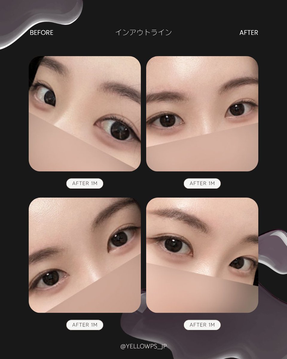 💛イエロー美容整形外科(公式)💛 tweet media