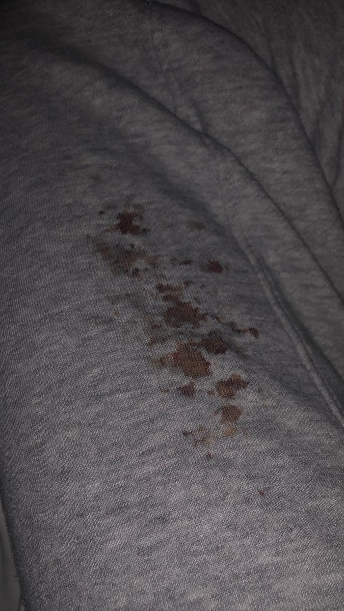 Ulrich of shtwt 𐂯 tweet media