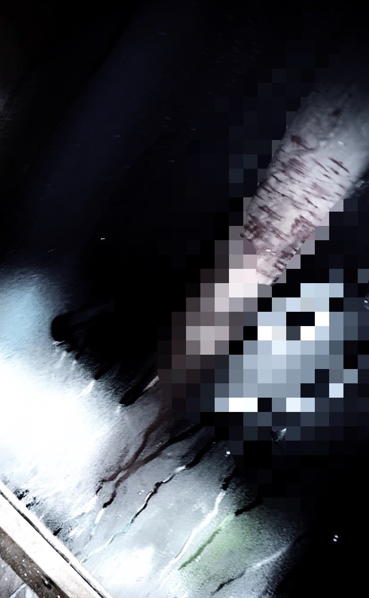 urprttycrpse's tweet image. Kai razor
125lbs bmi 17
#shtwt #shedtwt #blood #imakemyowngore