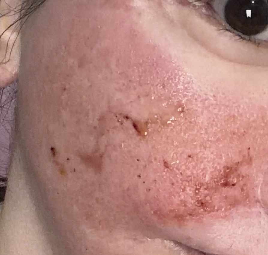 Rabichan🐰🩷整形YouTube👀 tweet media