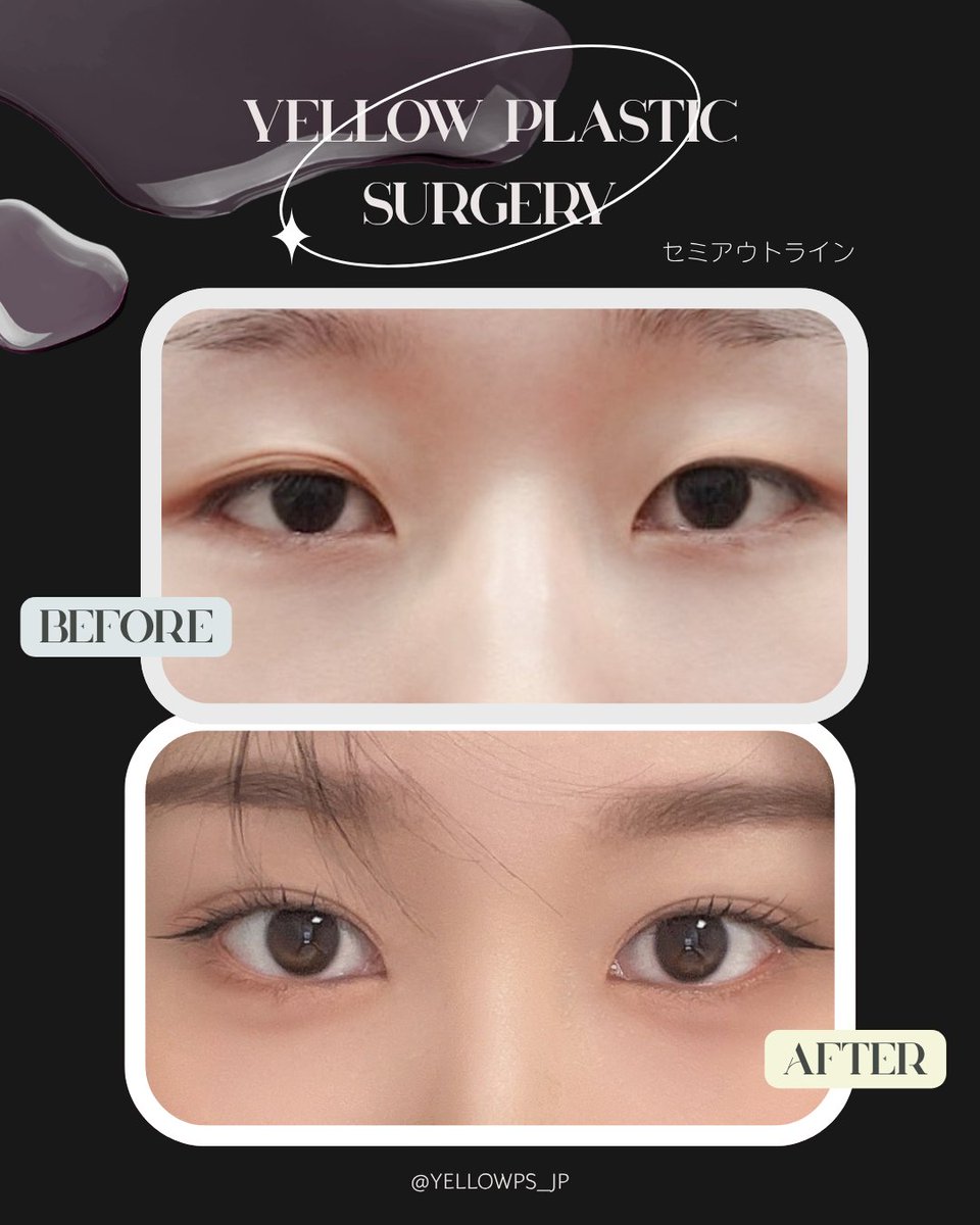 💛イエロー美容整形外科(公式)💛 tweet media