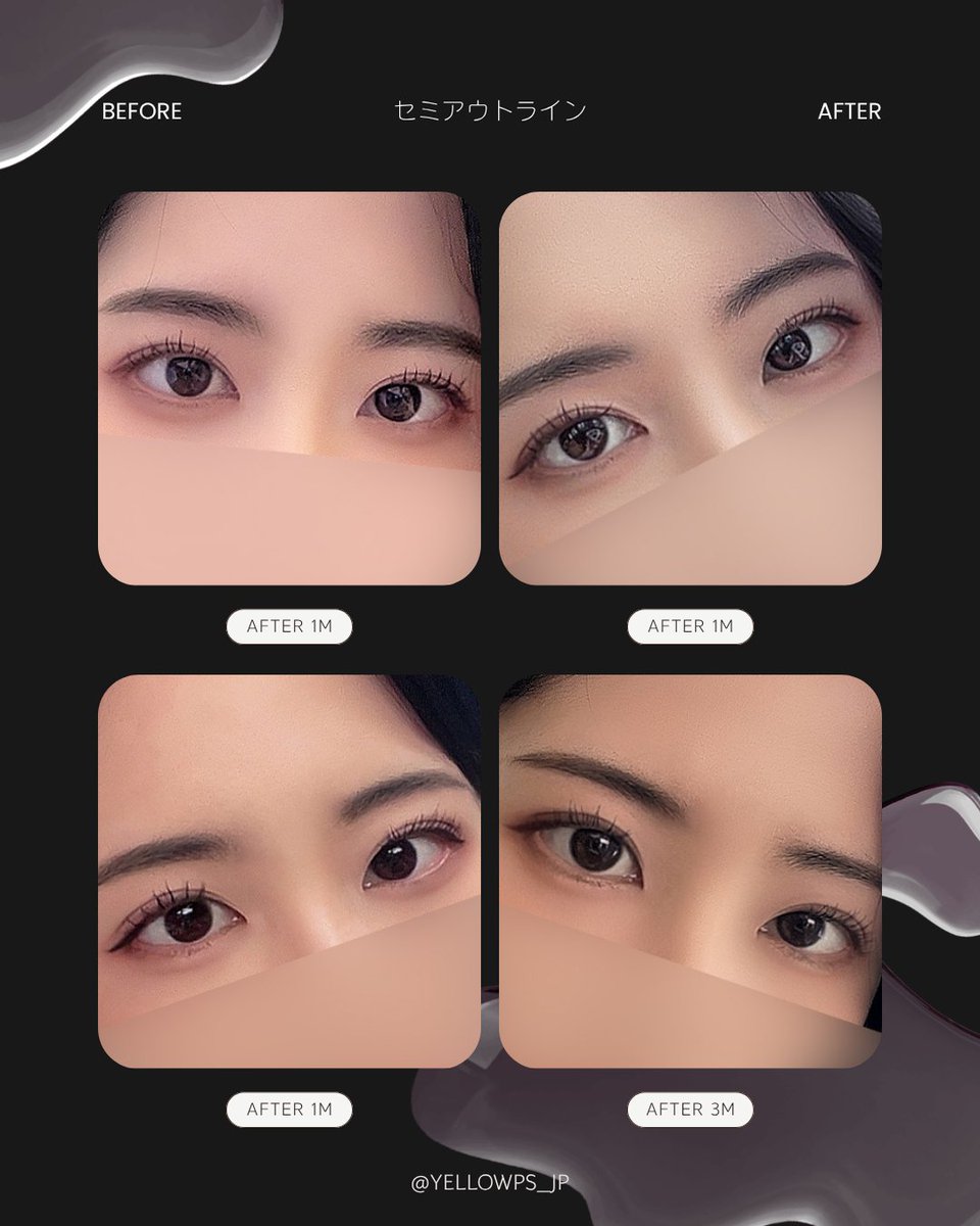 💛イエロー美容整形外科(公式)💛 tweet media