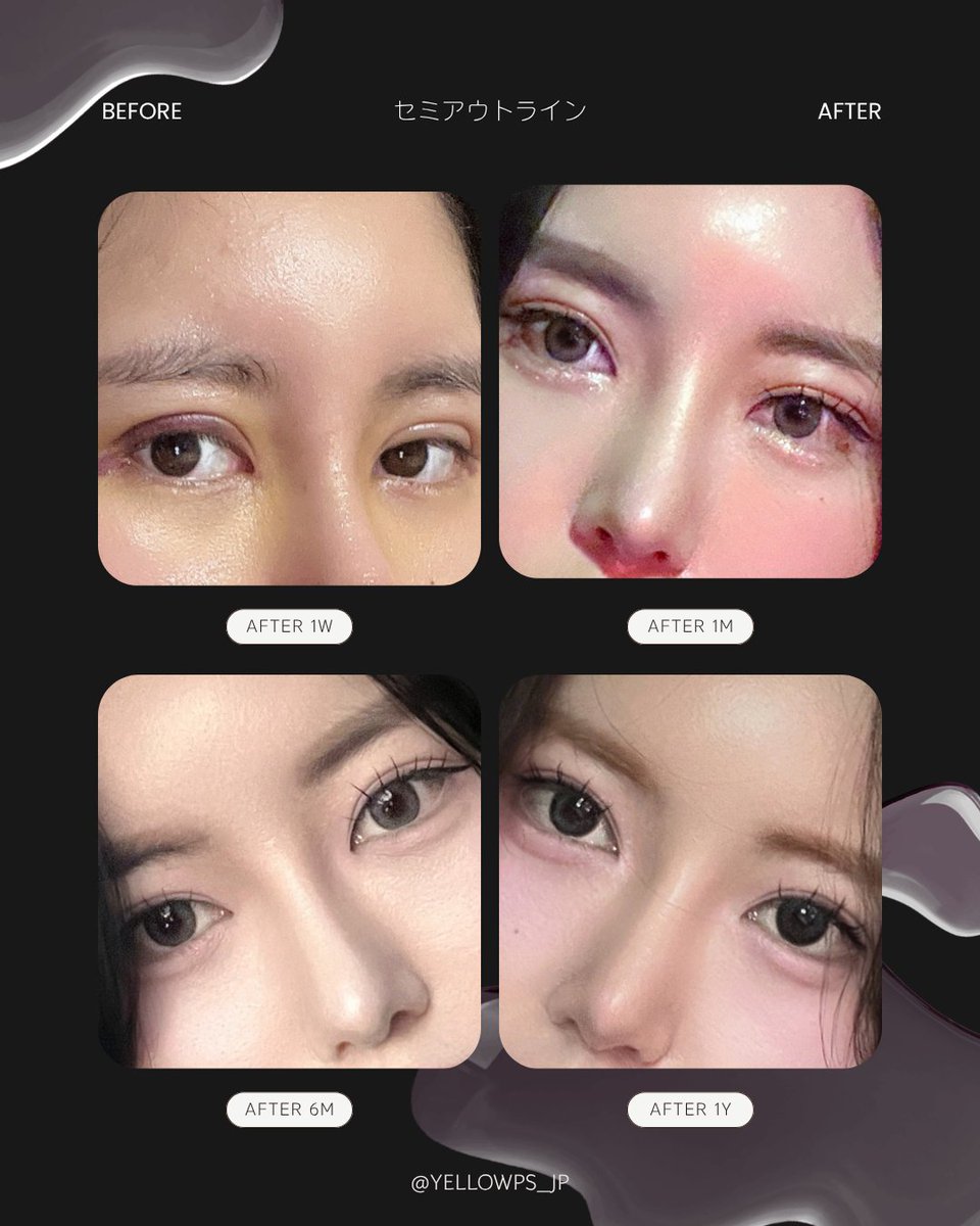 💛イエロー美容整形外科(公式)💛 tweet media