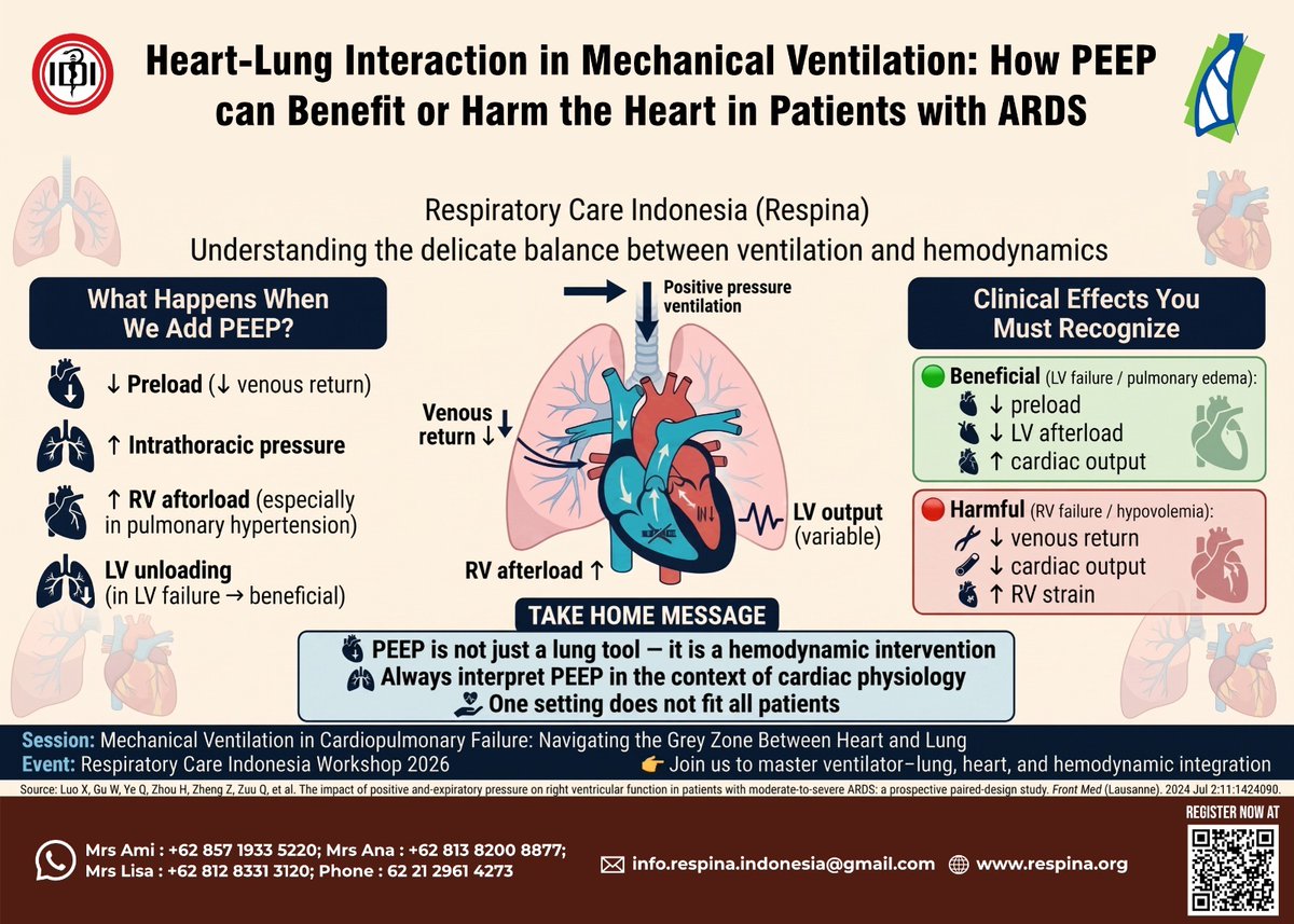 RespinaIndones1's tweet photo. “Join us to master ventilator - lung, heart, and hemodynamic intrgration!”

Join Respina 2026 Now!
👉https://t.co/Ug2MNSRx9f

Thank you
🙏 https://t.co/TsJRVEzKLv