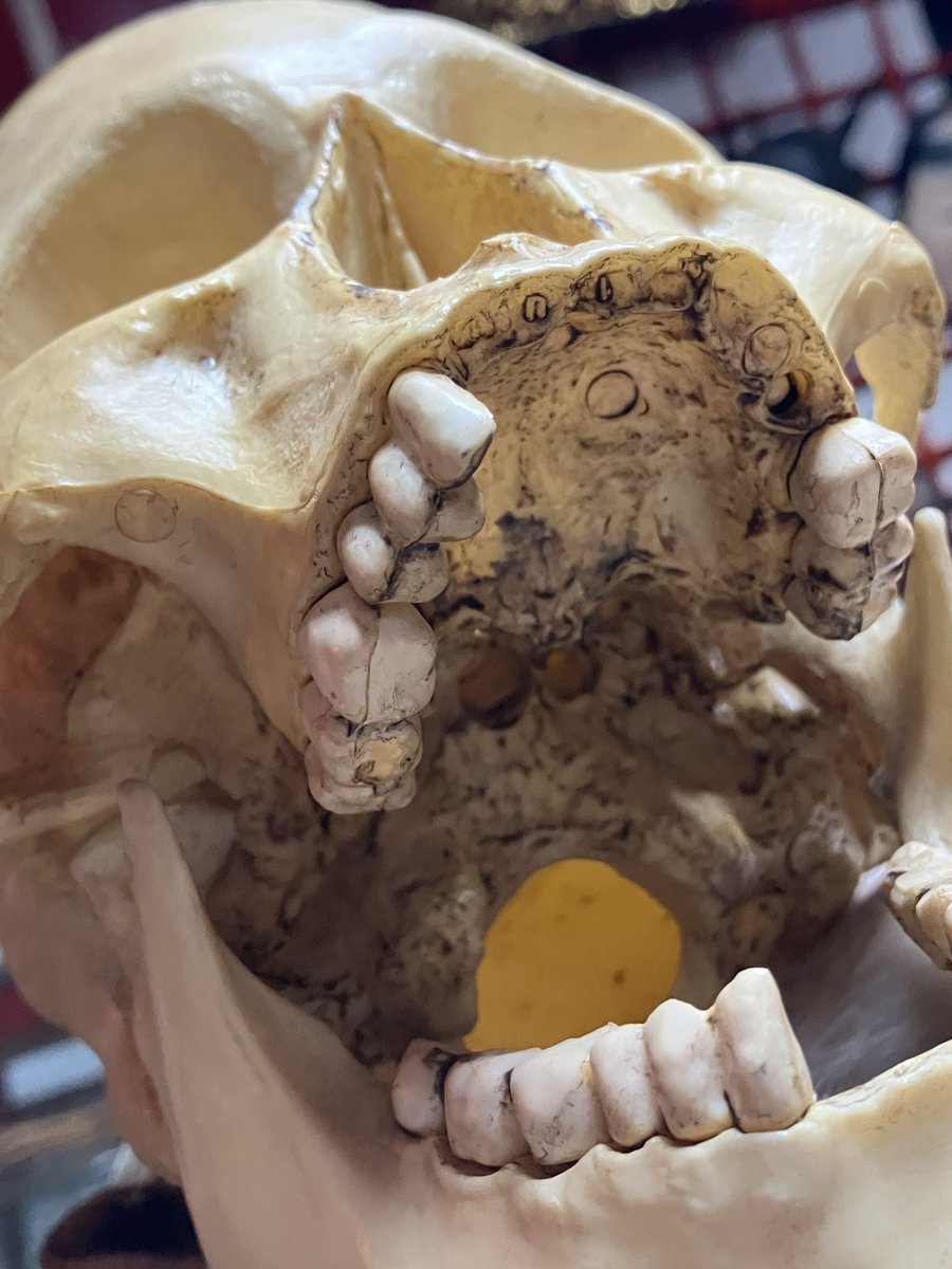 hakuchuum_osaka's tweet image. 人体模型
頭蓋骨の模型です。
汚れあります。
高さ17cm
6500円です。
通販ご希望の方はDMください。

#頭蓋骨
#skull