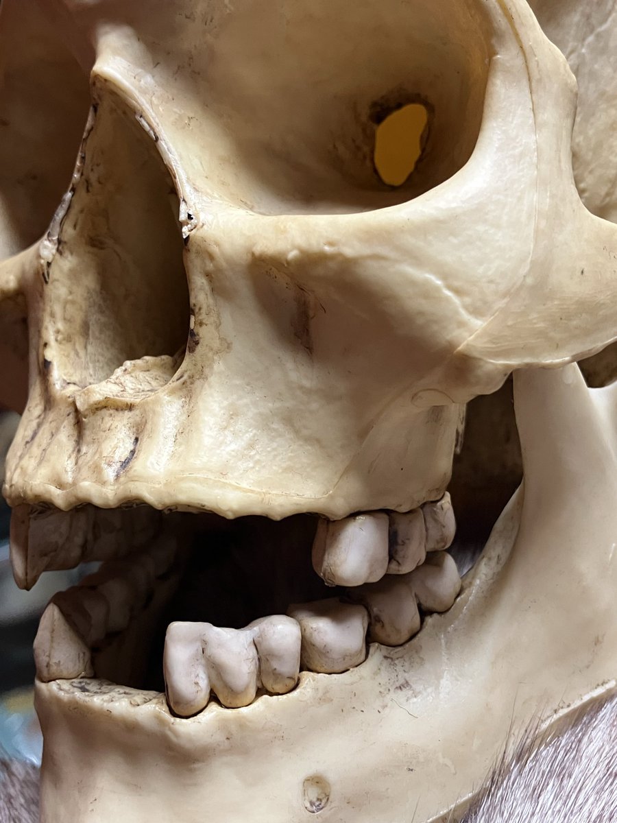 hakuchuum_osaka's tweet image. 人体模型
頭蓋骨の模型です。
汚れあります。
高さ17cm
6500円です。
通販ご希望の方はDMください。

#頭蓋骨
#skull