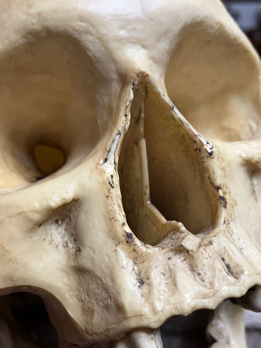 hakuchuum_osaka's tweet image. 人体模型
頭蓋骨の模型です。
汚れあります。
高さ17cm
6500円です。
通販ご希望の方はDMください。

#頭蓋骨
#skull