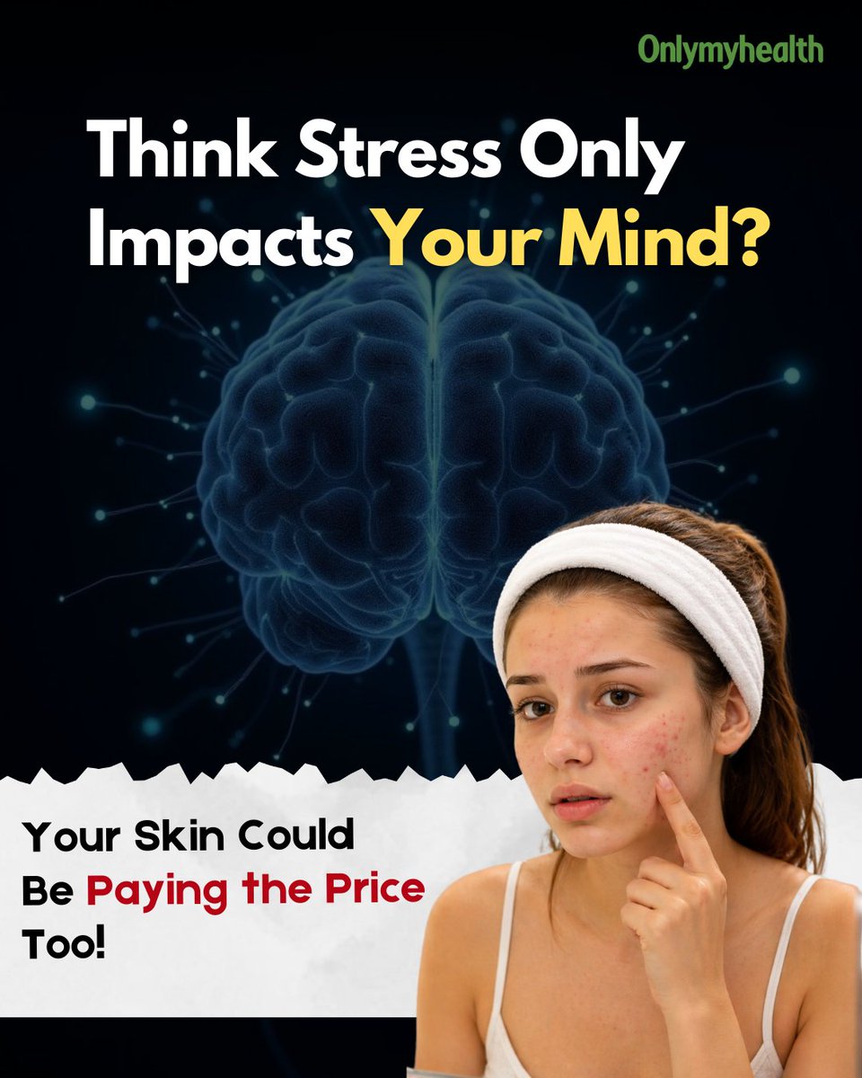 onlymyhealth's tweet image. Stress doesn’t just affect your mood—it shows on your skin too 👀
High cortisol can trigger acne, dryness, inflammation &amp;amp; flare-ups like eczema or psoriasis 😳
Take care of your stress for healthier, clearer skin ✨
#StressAndSkin #SkinHealth #MentalHealthMatters