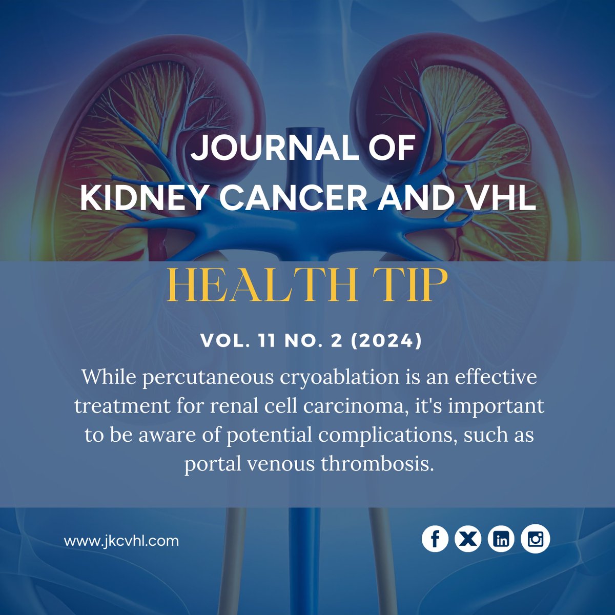 Jokcov's tweet photo. Percutaneous cryoablation is effective for RCC but may carry risks like portal venous thrombosis. Follow-up is key.

Read more: https://t.co/SetWEETsT2

#RCC #KidneyCancer #Oncology #CancerResearch https://t.co/W7YVF4tkAR