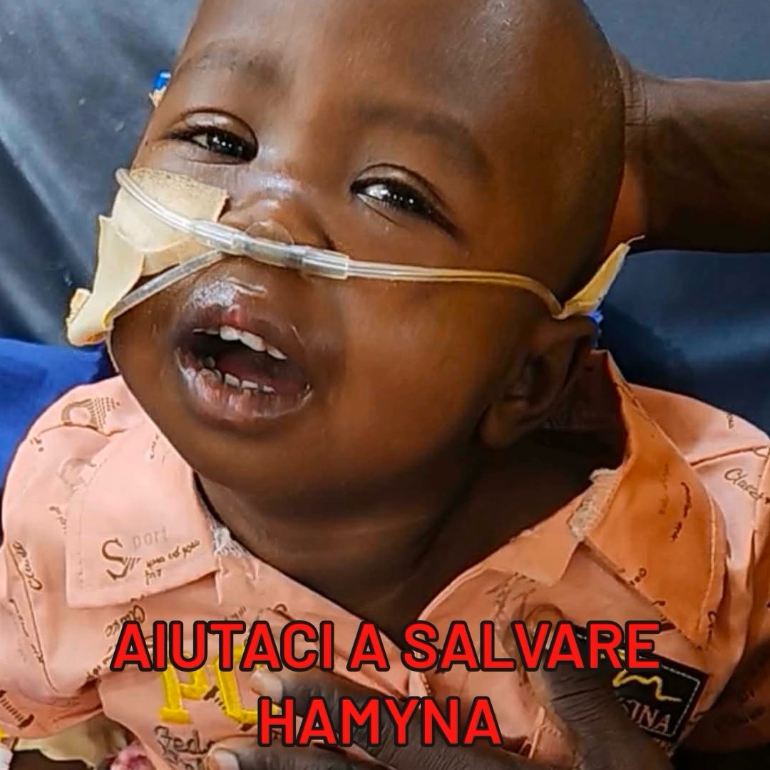 OSNMITALY's tweet image. A El Fasher, in #Sudan, i #bambini stanno pagando il prezzo più alto: mancano cibo, acqua e cure. Non possiamo restare indifferenti. Ogni voce conta, ogni condivisione può fare la differenza. 
Non lasciamoli morire 
Dona ora ⬇️⬇️
osnm.it/donazione