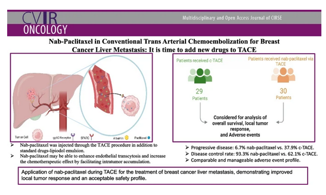 cvironco's tweet photo. Nab-paclitaxel in conventional trans arterial chemoembolization for breast cancer liver metastasis: it is time to add new drugs to TACE

 📃https://t.co/owHkVq4hnG

#BreastCancer #LiverMetastasis #InterventionalRadiology #InterventionalOncology https://t.co/zQVIaOIWWu