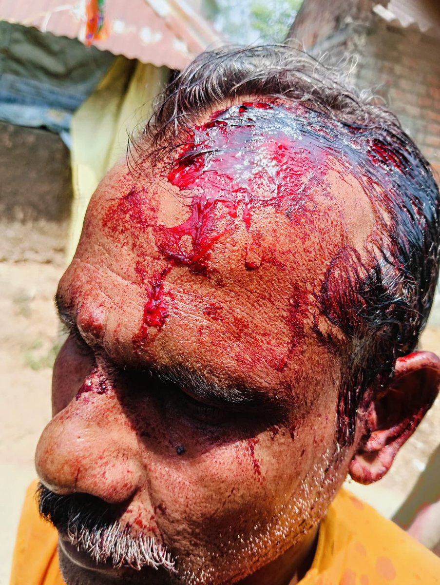 Biswajit Mondal, polling agent of BJP Candidate,Labhpur Debasish Ojha gets injured.

This is a seat where BJP is expecting to gain.

Attack on him just shows how scared TMC is.
