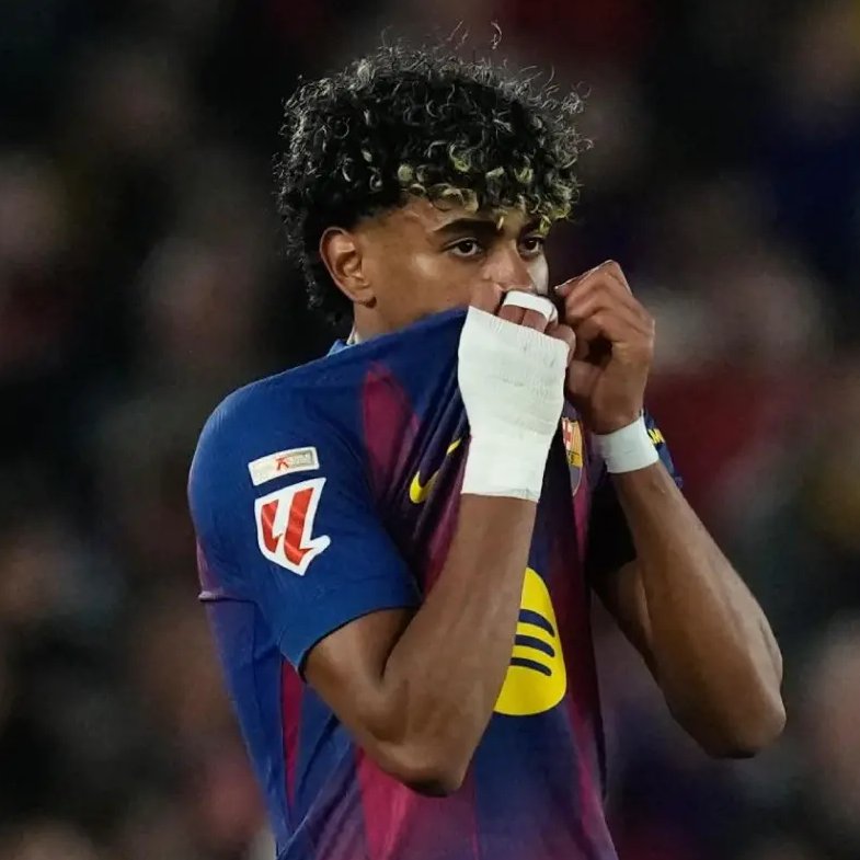 BarcaUniversal's tweet image. ❗️Dr Ripoll (expert in sports medicine): "Lamine Yamal's injury has a 30% recurrence rate, so extreme caution is needed with recovery timelines."

"If the injury is in the muscle belly, the prognosis is more favorable. But if it is located where the muscle meets the tendon or in